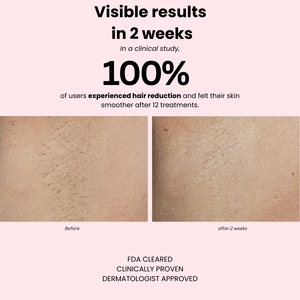 Sapphire Ice+ PRO - glazee skin