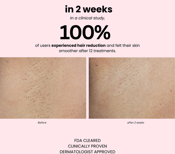 Sapphire Ice+ PRO - glazee skin