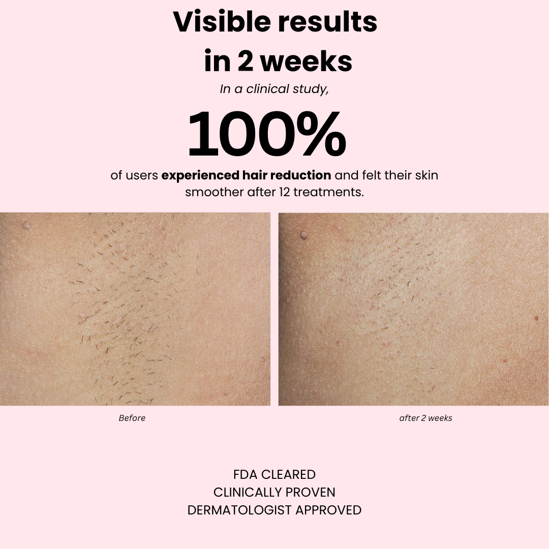 Sapphire Ice+ PRO - glazee skin